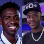 Vinicius Goes Viral On Social Media Over Alleged Cosmetic Procedure