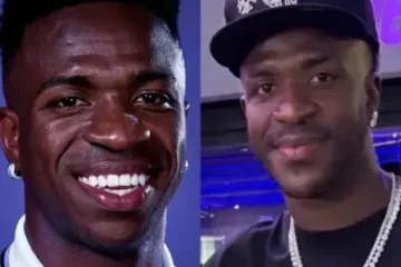 Vinicius Goes Viral On Social Media Over Alleged Cosmetic Procedure