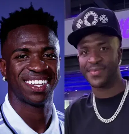 Vinicius Goes Viral On Social Media Over Alleged Cosmetic Procedure
