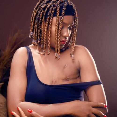 Not Easy To Show My Scars, But I’m Proud To Break Deadly Silence Around Nigeria’s Breast Cancer Crisis