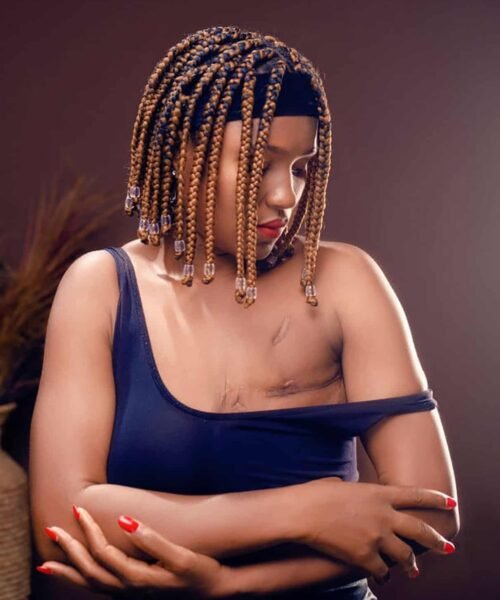 Not Easy To Show My Scars, But I’m Proud To Break Deadly Silence Around Nigeria’s Breast Cancer Crisis